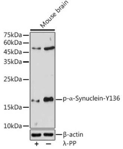 alpha-Synuclein, p Tyr136 Antibody - Azide and BSA Free, Novus Biologicals:Antibodies:Primary